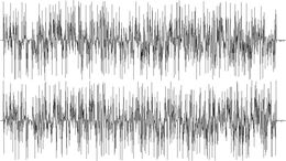 PELEA 1 - CAMPAÑA UNICENTER