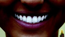 DIENTES