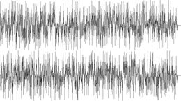 ARNET